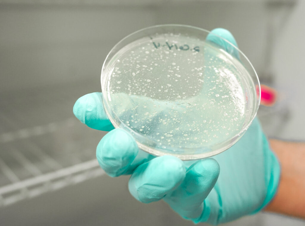 Cyclospora in a laboratory testing