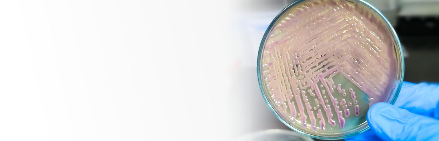 Pathogen | Microbac Laboratories