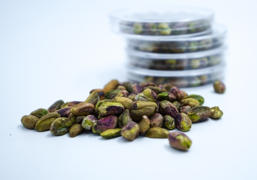 Phosphorus (Food Heavy Metal - ICP)